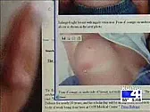 INFLAMMATORY  Breast Cancer |  Pat:As I said in my message, r.c.t.n. doesn't worry a lot about top...