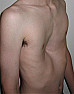 Hollow chest pattern adjustment |  I need to make a hollow chest adjustment on a sleeveless, round necked, top and...